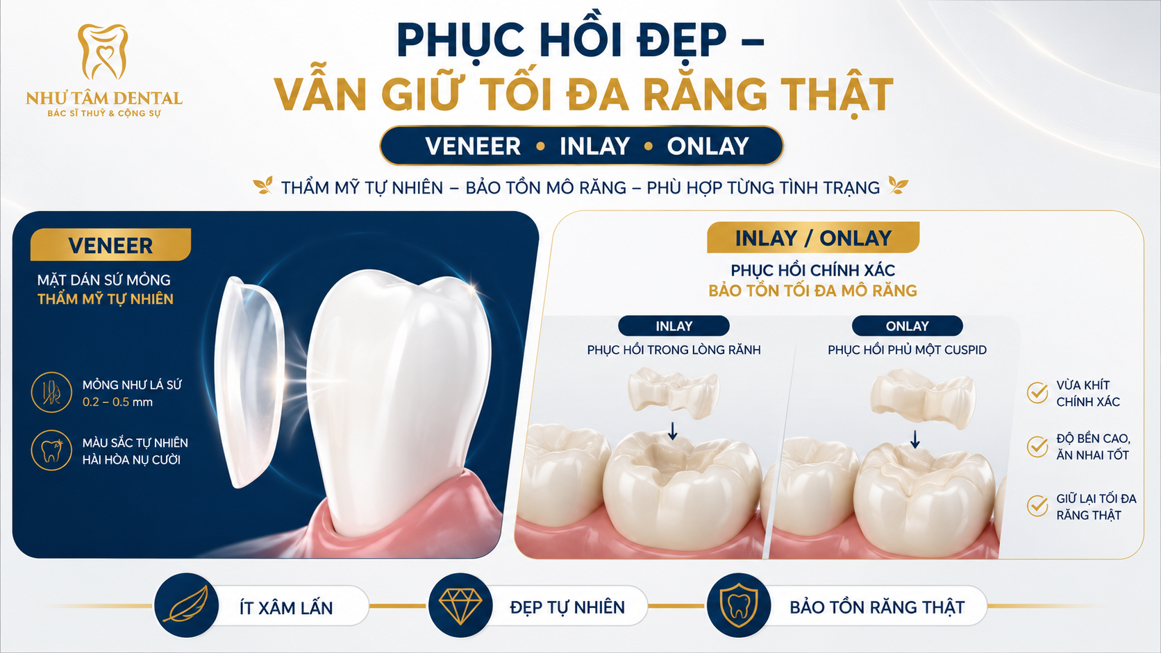 Minh họa phục hồi răng bằng Veneer, Inlay/Onlay theo hướng ít xâm lấn, giúp cải thiện thẩm mỹ và ăn nhai nhưng vẫn ưu tiên bảo tồn răng thật tại Nha Khoa Như Tâm.