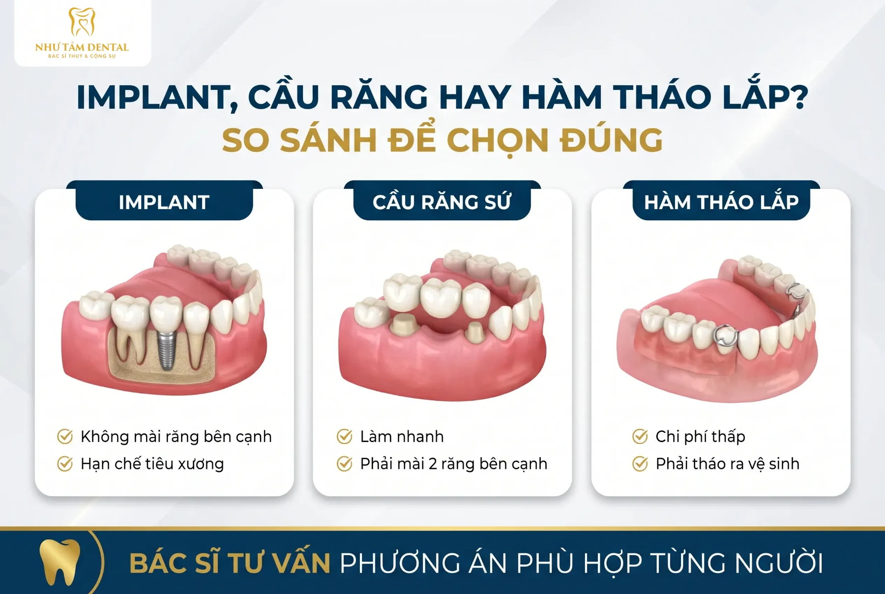 So sánh ba cách phục hồi răng mất: implant, cầu răng sứ và hàm tháo lắp – Nha Khoa Như Tâm